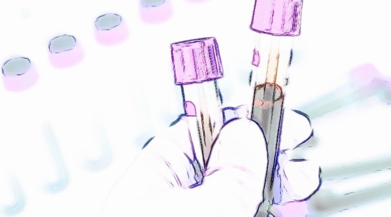 血液検査
