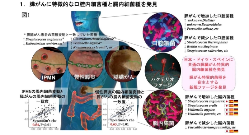 膵がんに特徴的な口腔内細菌種と腸内細菌種を発見